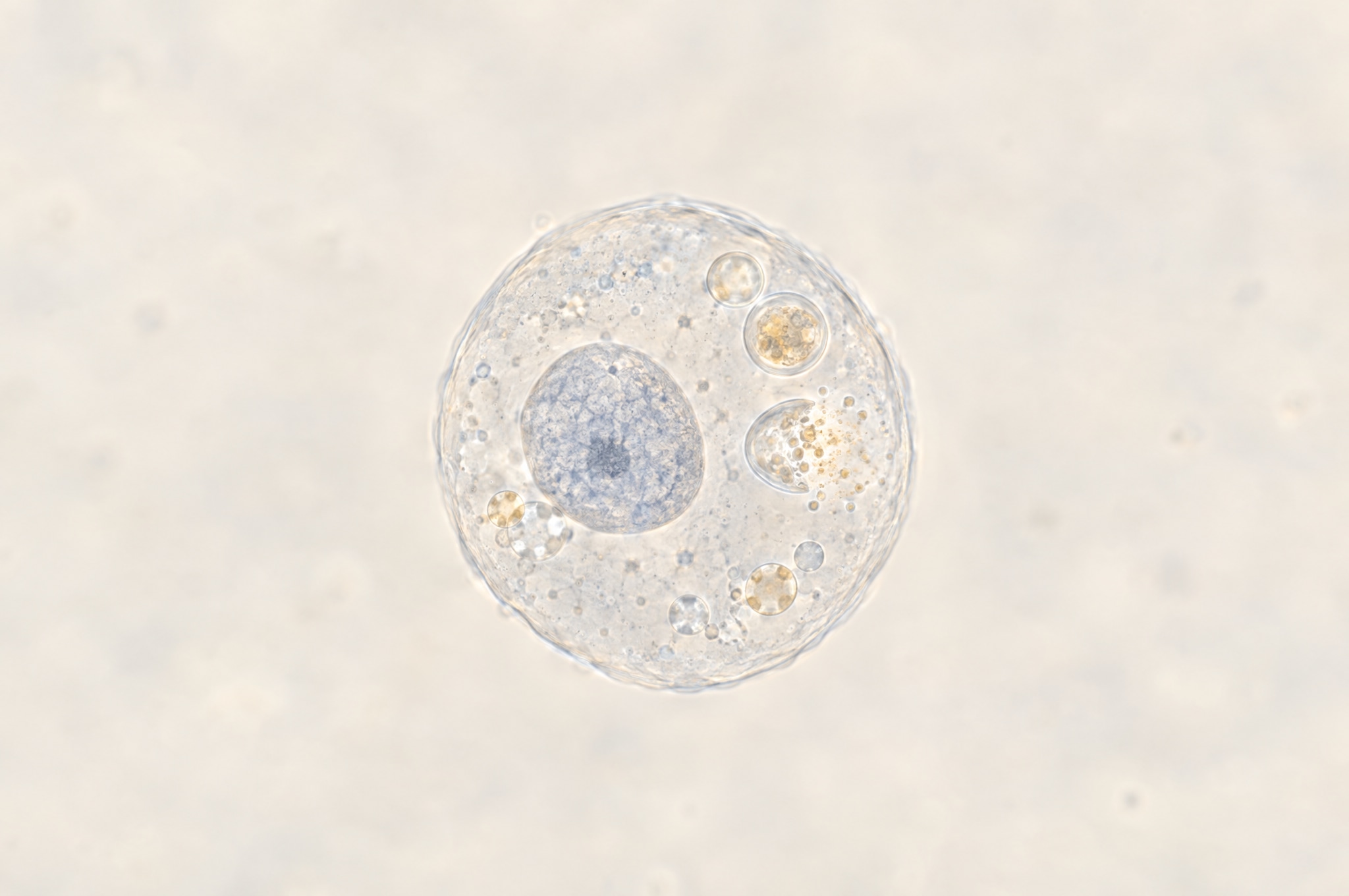 Cell illustration: Cellular cleanup (autophagy)
